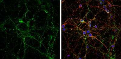 Immunocytochemistry/Immunofluorescence: VGLUT2 Antibody [NBP3-13164] - VGLUT2 antibody detects VGLUT2 protein by immunofluorescent analysis. Sample: DIV9 rat E18 primary cortical neuron cells were fixed in 4% paraformaldehyde at RT for 15 min. Green: VGLUT2 stained by VGLUT2 antibody (NBP3-13164) diluted at 1:500. Red: beta Tubulin 3/ Tuj1, stained by beta Tubulin 3/ Tuj1 antibody [GT1338] (NBP3-13505) diluted at 1:500. Blue: Fluoroshield with DAPI.