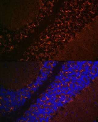 Immunohistochemistry: VGLUT2 Antibody [NBP2-94571] - Analysis of mouse brain using VGLUT2 . Blue: DAPI for nuclear staining.