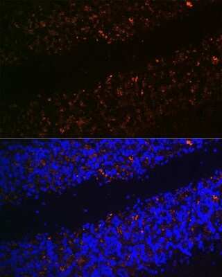 Immunohistochemistry: VGLUT2 Antibody [NBP2-94571] - Analysis of rat brain using VGLUT2 . Blue: DAPI for nuclear staining.