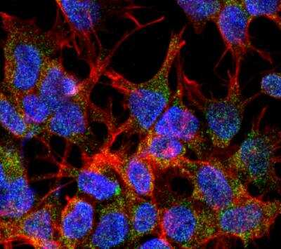 Immunocytochemistry/Immunofluorescence: VGLUT2 Antibody (S29-29) [NBP2-59330] - Tissue: SK-N-BE Cells (Human Neuroblastoma cells). Species: Human. Fixation: 4% Formaldehyde for 15 min at RT. Primary Antibody: Mouse Anti-VGLUT2 Monoclonal Antibody at 1:100 for 60 min at RT. Secondary Antibody: Goat Anti-Mouse ATTO 488 at 1:200 for 60 min at RT. Counterstain: Phalloidin Texas Red F-Actin stain; DAPI (blue) nuclear stain at 1:1000, 1:5000 for 60 min at RT, 5 min at RT. Localization: Cytoplasmic Vesicle, Secretory Vesicle, Synaptic Vesicle Membrane, Membrane, Cell Junction, Synapse. Magnification: 60X.