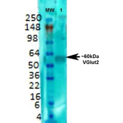 Western Blot: VGLUT2 Antibody (S29-29) [NBP2-59330] - Western Blot analysis of Rat brain membrane lysate showing detection of VGLUT2 protein using Mouse Anti-VGLUT2 Monoclonal Antibody, Clone S29-29 (NBP2-59330). Primary Antibody: Mouse Anti-VGLUT2 Monoclonal Antibody (NBP2-59330) at 1:000.