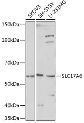 Western Blot: VGLUT2 Antibody [NBP2-94571] - Analysis of extracts of various cell lines, using VGLUT2 at 1:1000 dilution. Secondary antibody: HRP Goat Anti-Rabbit IgG (H+L) at 1:10000 dilution. Lysates/proteins: 25ug per lane. Blocking buffer: 3% nonfat dry milk in TBST. Detection: ECL Basic Kit . Exposure time: 10s.