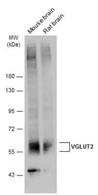 Western Blot: VGLUT2 Antibody [NBP3-13164] - Various tissue extracts (50 ug) were separated by 7.5% SDS-PAGE, and the membrane was blotted with VGLUT2 antibody (NBP3-13164) diluted at 1:1000. The HRP-conjugated anti-rabbit IgG antibody (NBP2-19301) was used to detect the primary antibody.