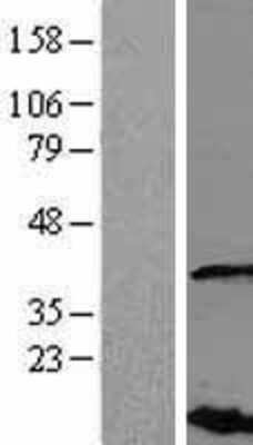 Western Blot: VHLL Overexpression Lysate (Adult Normal) [NBL1-17720] Left-Empty vector transfected control cell lysate (HEK293 cell lysate); Right -Over-expression Lysate for VHLL.