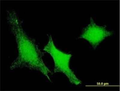Immunocytochemistry/Immunofluorescence: VHR/DUSP3 Antibody (5B7) [H00001845-M01] - Analysis of monoclonal antibody to DUSP3 on HeLa cell . Antibody concentration 10 ug/ml.