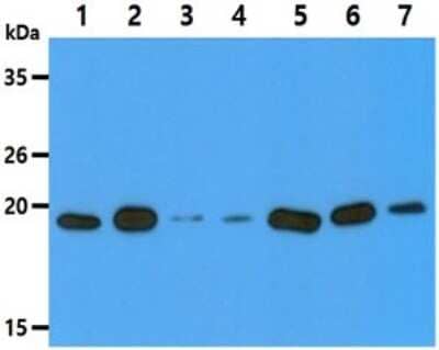 Western Blot: VHR/DUSP3 Antibody (9E6) [NBP2-59460] - Lane 1: HeLa cell lysates, Lane 2: HepG2 cell lysates, Lane 3: Jurkat cell lysates, Lane 4: MCF7 cell lysates, Lane 5: 293T cell lysates, Lane 6: U87MG cell lysates, Lane 7: K562 cell lysates