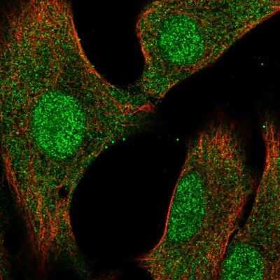 Immunocytochemistry/Immunofluorescence: VHR/DUSP3 Antibody [NBP2-57387] - Staining of human cell line A549 shows localization to nucleoplasm & cytosol.