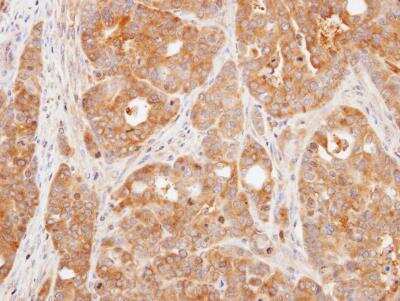 Immunohistochemistry-Paraffin VHR/DUSP3 Antibody - BSA Free