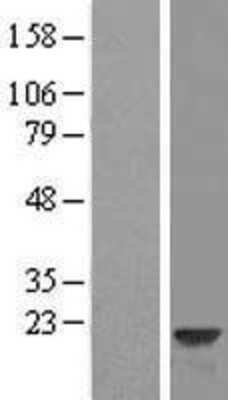 Western Blot: VILIP3 Overexpression Lysate (Adult Normal) [NBL1-11688] Left-Empty vector transfected control cell lysate (HEK293 cell lysate); Right -Over-expression Lysate for VILIP3.