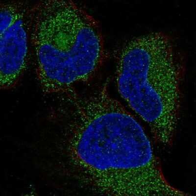 Immunocytochemistry/Immunofluorescence: VIP Antibody [NBP2-57264] - Staining of human cell line HeLa shows localization to endoplasmic reticulum.