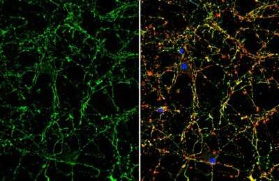 Immunocytochemistry/Immunofluorescence: VIP Antibody [NBP3-12899] - VIP antibody detects VIP protein by immunofluorescent analysis. Sample: DIV10 rat E18 primary cortical neuron cells were fixed in 4% paraformaldehyde at RT for 15 min. Green: VIP stained by VIP antibody (NBP3-12899) diluted at 1:500. Red: beta Tubulin 3/ Tuj1, stained by beta Tubulin 3/ Tuj1 antibody [GT11710] (NBP2-43559) diluted at 1:500. Blue: Fluoroshield with DAPI.