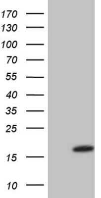 Western Blot: VIP Antibody (OTI1E8) - Azide and BSA Free [NBP2-74848] - Analysis of HEK293T cells were transfected with the pCMV6-ENTRY control (Left lane) or pCMV6-ENTRY VIP.