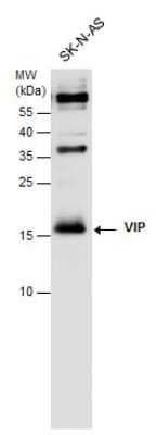 Western Blot: VIP Antibody [NBP3-12899] - VIP antibody detects VIP protein by western blot analysis. Whole cell extracts (30 ug) was separated by 15% SDS-PAGE, and the membrane was blotted with VIP antibody (NBP3-12899) diluted at 1:1000.