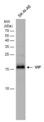 Western Blot: VIP Antibody [NBP3-12900] - VIP antibody detects VIP protein by western blot analysis. Whole cell extracts (30 ug) was separated by 15% SDS-PAGE, and the membrane was blotted with VIP antibody (NBP3-12900) at a dilution of 1:1000.