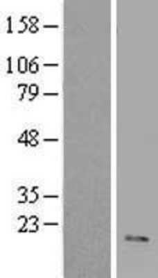 Western Blot VIP Overexpression Lysate