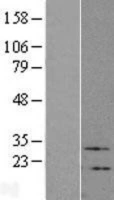 Western Blot VIP Overexpression Lysate