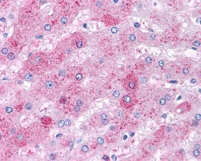 Immunohistochemistry-Paraffin: VIP R2/VPAC2 Antibody [NLS1306] - Analysis of anti-VIPR2 antibody in human liver cells. 