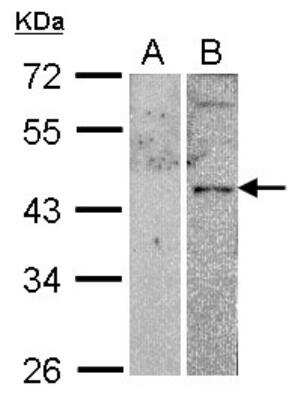 Western Blot: VIP R2/VPAC2 Antibody [NBP2-20867] - Analysis of VPAC2 expression in transfected 293T cell line (20ug of whole cell ltsate) A: Non-transfected lysate. B: VPAC2 transfected lysate. 10% SDS PAGE gel, diluted at 1:1000.