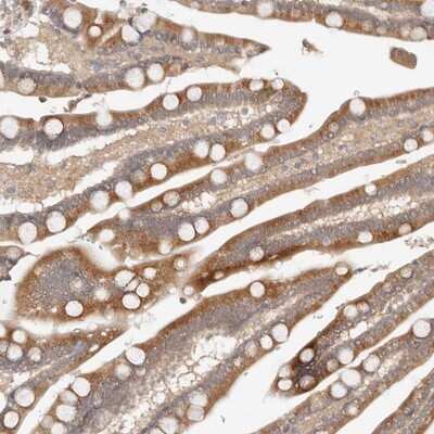 Immunohistochemistry-Paraffin VIPAR Antibody