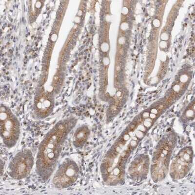 Immunohistochemistry-Paraffin VIPAR Antibody