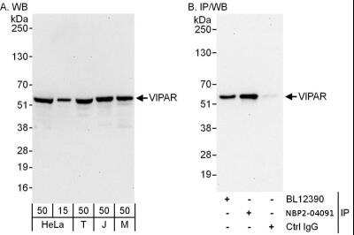 Immunoprecipitation: VIPAR Antibody [NBP2-04091] - Samples: Whole cell lysate from HeLa (15 and 50 ug for WB; 1 mg for IP, 20% of IP loaded), 293T (50 ug), Jurkat (50 ug) and mouse NIH3T3 (50 ug) cells. Antibodies: Affinity purified rabbit anti-VIPAR antibody used for WB at 0.1 ug/ml (A) and 1 ug/ml (B) and used for IP at 6 ug/mg lysate. VIPAR was also immunoprecipitated by rabbit anti-VIPAR antibody BL12390, which recognizes an upstream epitope. Detection: Chemiluminescence with exposure times of 30 seconds (A and B).