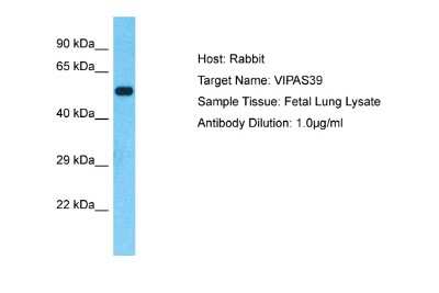 Western Blot: VIPAR Antibody [NBP2-88574] - Host: Rabbit. Target Name: VIPAS39. Sample Type: Fetal Lung lysates. Antibody Dilution: 1.0ug/ml