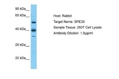 Western Blot: VIPAR Antibody [NBP2-88575] - Host: Rabbit. Target Name: SPE39. Sample Type: 293T Whole Cell lysates. Antibody Dilution: 1.0ug/ml