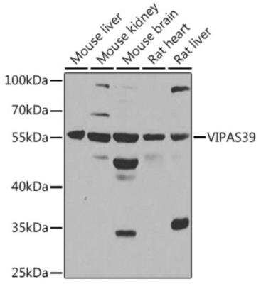 Western Blot: VIPAR Antibody [NBP2-94018] - Western blot analysis of extracts of various cell lines, using VIPAR at 1:1000 dilution.Secondary antibody: HRP Goat Anti-Rabbit IgG (H+L) at 1:10000 dilution. Lysates/proteins: 25ug per lane. Blocking buffer: 3% nonfat dry milk in TBST. Detection: ECL Basic Kit. Exposure time: 5s.