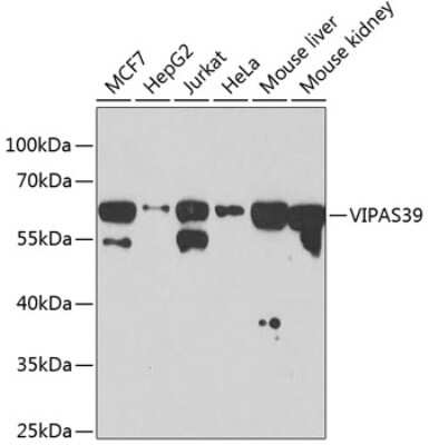 Western Blot: VIPAR Antibody [NBP2-94308] - Analysis of extracts of various cell lines, using VIPAR at 1:1000 dilution. Secondary antibody: HRP Goat Anti-Rabbit IgG (H+L) at 1:10000 dilution. Lysates/proteins: 25ug per lane. Blocking buffer: 3% nonfat dry milk in TBST. Detection: ECL Basic Kit . Exposure time: 15s.