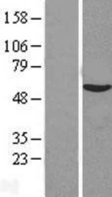 Western Blot: VIPAR Overexpression Lysate (Adult Normal) [NBL1-08175] Left-Empty vector transfected control cell lysate (HEK293 cell lysate); Right -Over-expression Lysate for VIPAR.