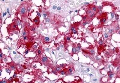Immunohistochemistry-Paraffin: VIPR1/VPAC1 Antibody - BSA Free [NB100-58986] - Analysis of anti-VIP Receptor 1 antibody with human adrenal medulla at concentration 20 ug/ml.