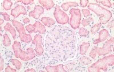 Immunohistochemistry-Paraffin: VIPR1/VPAC1 Antibody - BSA Free [NB100-58986] - Immunohistochemical analysis of formalin-fixed, paraffin-embedded human kidney tissue.