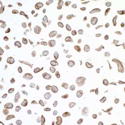 Immunocytochemistry/Immunofluorescence: VISTA/B7-H5/PD-1H Antibody (BLR035F) [NBP2-76406] - Detection of human VISTA in FFPE NCI-H226 cells by ICC. Antibody: Rabbit anti-VISTA recombinant monoclonal [BLR035F] (NBP2-76406). Secondary: HRP-conjugated goat anti-rabbit IgG. Substrate: DAB.