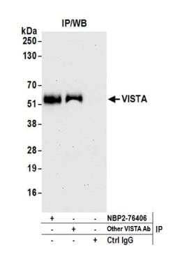 <b>Independent Antibodies Validation. </b>Immunoprecipitation: VISTA/B7-H5/PD-1H Antibody (BLR035F) [NBP2-76406] - Detection of human VISTA by WB of immunoprecipitates from Jurkat lysate. Antibodies: Rabbit anti-VISTA recombinant monoclonal [BLR035F] (NBP2-76406) and another rabbit anti-VISTA recombinant monoclonal.