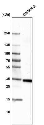 Western Blot: VISTA/B7-H5/PD-1H Antibody (CL3975) [NBP2-59030] - Analysis in human cell line CAPAN-2.