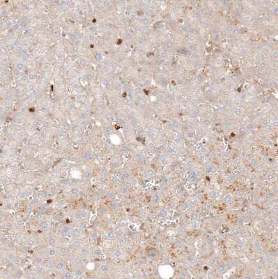 Immunohistochemistry-Paraffin: VISTA/B7-H5/PD-1H Antibody [NBP1-88967] - Staining of human liver shows strong cytoplasmic positivity in leukocytes.