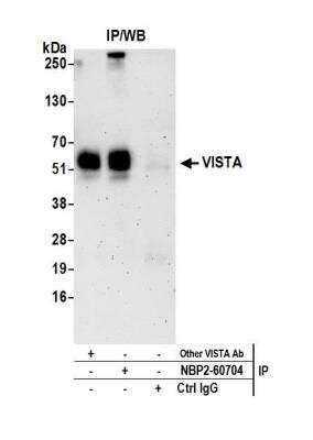 VISTA/B7-H5/PD-1H Antibody [NBP2-60704] - Detection of human VISTA by western blot of immunoprecipitates. Samples: Whole cell lysate (0.5 or 1.0 mg per IP reaction; 20% of IP loaded) from Jurkat cells prepared using NETN lysis buffer. Antibodies: Affinity purified rabbit anti-VISTA antibody NBP2-60704 used for IP at 8 ul per reaction. VISTA was also immunoprecipitated by another rabbit anti-VISTA antibody. Detection: Chemiluminescence with an exposure time of 3 minutes.