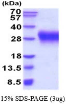 SDS-Page: Recombinant Human VISTA/B7-H5/PD-1H Protein [NBP2-52255] - 15% SDS Page (3 ug)