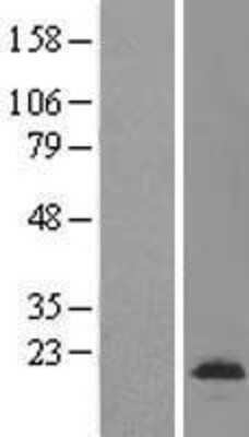 Western Blot: VKORC1L1 Overexpression Lysate (Adult Normal) [NBL1-17728] Left-Empty vector transfected control cell lysate (HEK293 cell lysate); Right -Over-expression Lysate for VKORC1L1.