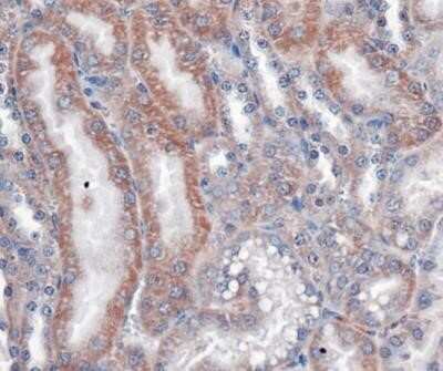 Immunohistochemistry: VLDLR Antibody (6A6) - Azide and BSA Free [NBP2-81010] - Analysis of VLDL Receptor in mouse kidney. Image from the standard format of this antibody.