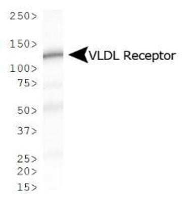 Western Blot: VLDLR Antibody (6A6) - Azide and BSA Free [NBP2-81010] - Analysis of VLDL Receptor expression in mouse kidney. Image from the standard format of this antibody.