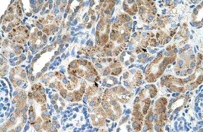 Immunohistochemistry-Paraffin: VMA21 Antibody [NBP1-59918] - Human kidney Tissue, antibody concentration 4-8ug/ml. Cells with positive label: renal corpuscle cells (indicated with arrows) 400X magnification.