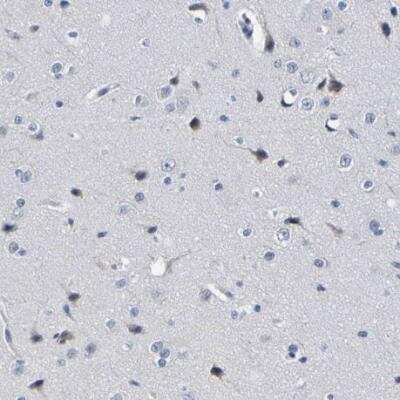 Immunohistochemistry-Paraffin VMA21 Antibody