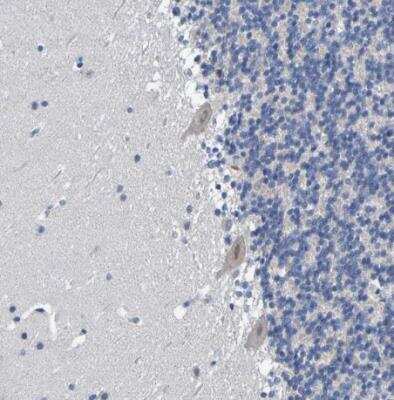 Immunohistochemistry-Paraffin VMA21 Antibody