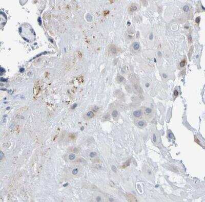 Immunohistochemistry-Paraffin VMA21 Antibody