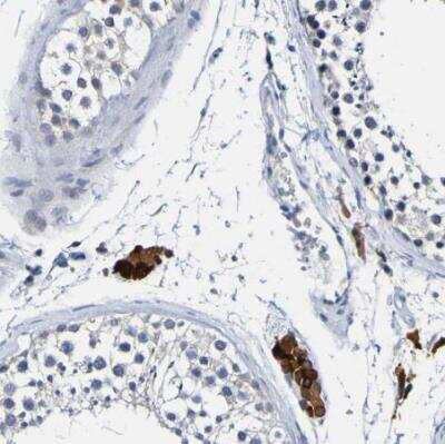 Immunohistochemistry-Paraffin: VMA21 Antibody [NBP1-82783] - Staining of human testis shows strong cytoplasmic positivity in Leydig cells.