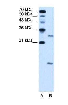 Western Blot: VMA21 Antibody [NBP1-59918] - HepG2 cell lysate, Antibody Titration: 5.0ug/ml