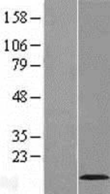 Western Blot: VMA21 Overexpression Lysate (Adult Normal) [NBL1-12586] Left-Empty vector transfected control cell lysate (HEK293 cell lysate); Right -Over-expression Lysate for VMA21.