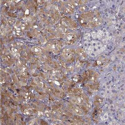 Immunohistochemistry-Paraffin: VMAT1/SLC18A1 Antibody [NBP2-58895] - Staining of human adrenal gland shows high expression.