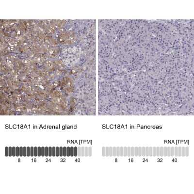 Immunohistochemistry-Paraffin: VMAT1/SLC18A1 Antibody [NBP2-58895] - Analysis in human adrenal gland and pancreas tissues using NBP2-58895 antibody. Corresponding VMAT1/SLC18A1 RNA-seq data are presented for the same tissues.